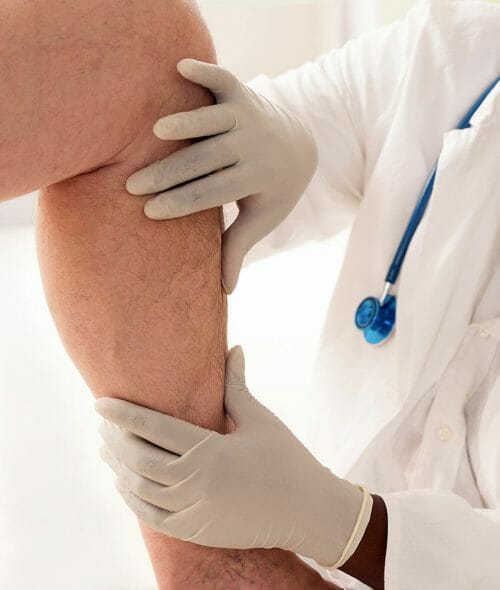 Superglue for Varicose Veins Treatment– Really?: Midwest Institute for  Non-Surgical Therapy: Vascular and Interventional Radiologists